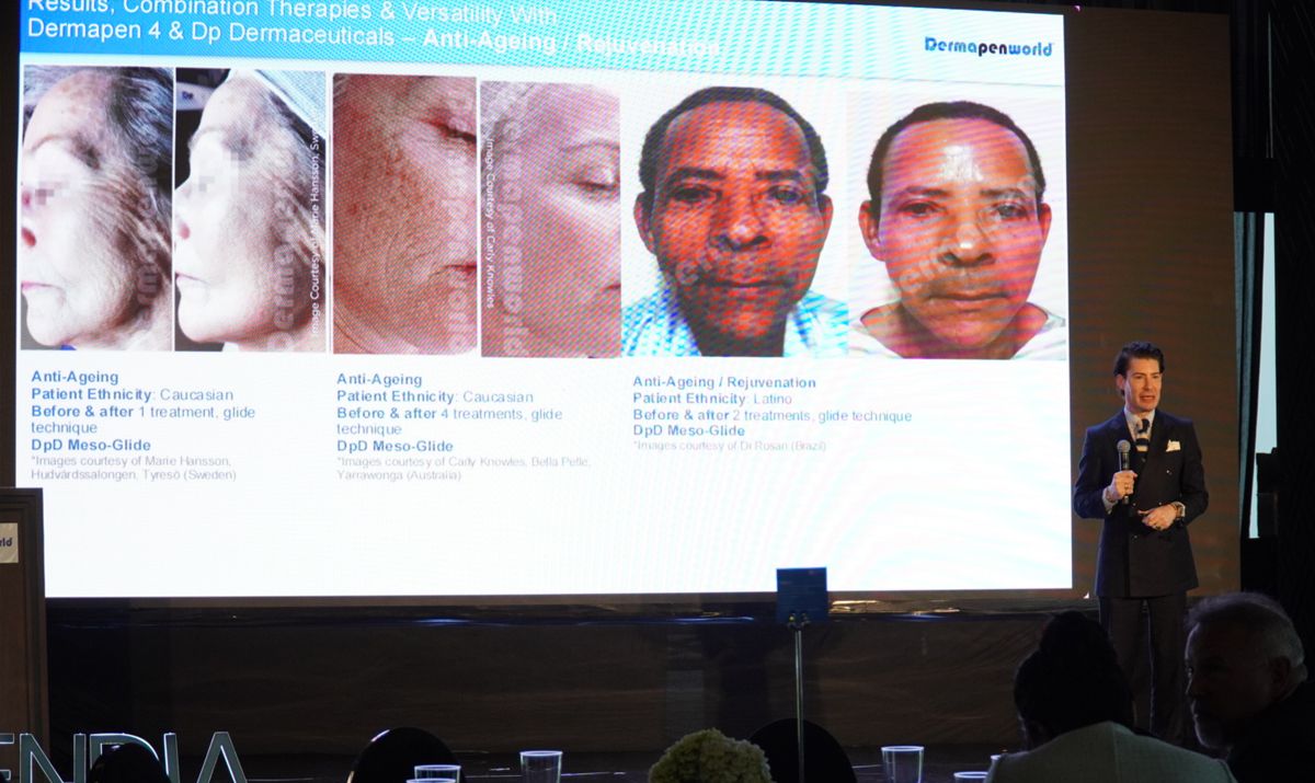 dermapenworld-event-edukasi-microneedling-jakarta