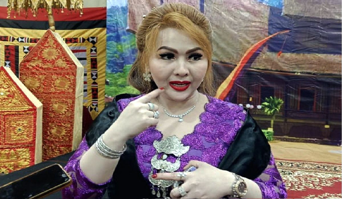 Bleaching Gigi Populer, drg. Deni Syafri Ingatkan Risiko Kesehatan